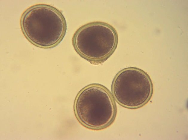 https://www.lavet.cl/wp-content/uploads/2023/01/Huevos-Toxocara.png